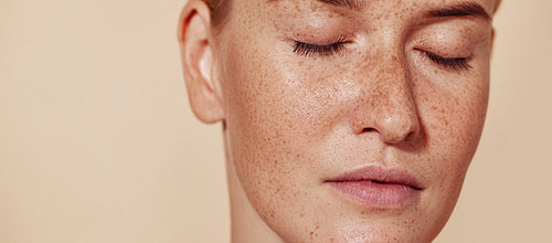 Cropped image of a young female with perfect natural skin with freckles