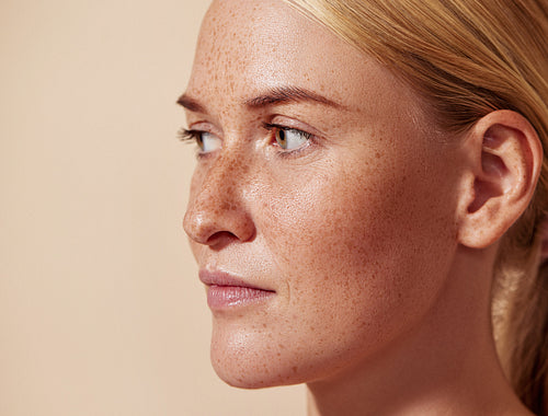 Close-up portrait of a beautiful female with freckles looking away